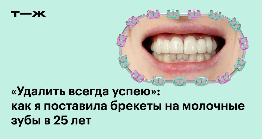 Растить зубы. Третий зуб слова. статус про молочные зубы. могут ли зубы вырасти в 3 раз.