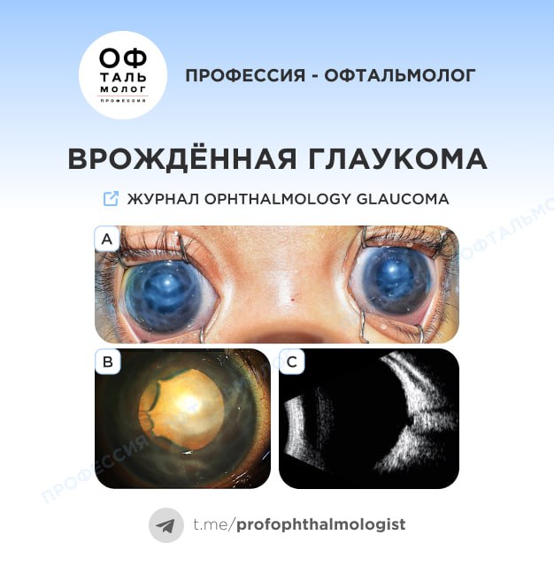 Публикация #747 — Профессия – офтальмолог (@profophthalmologist)