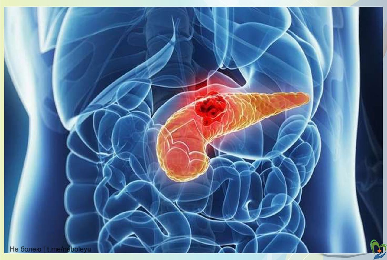 Поджелудочная железа человека. Злокачественное новообразование поджелудочной железы. Поджелудочная какой доктор. Поджелудочная железа pancreas. Панкреатит поджелудочной железы.