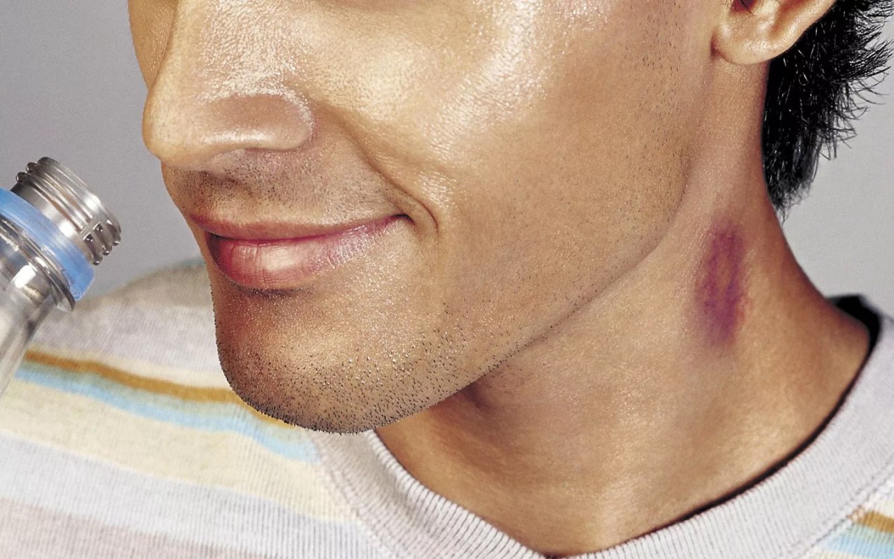 Эффективные способы скрыть и замаскировать следы засоса